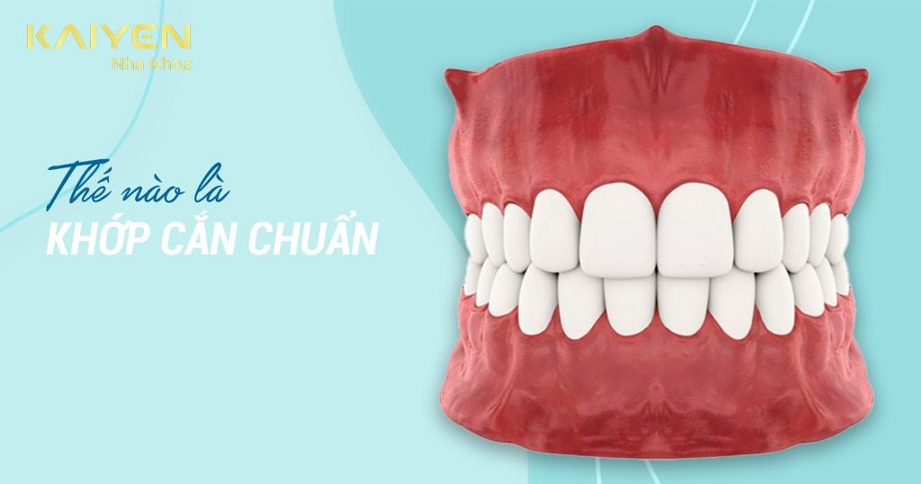 Khớp cắn chuẩn là như thế nào? 3 cách để có khớp cắn chuẩn