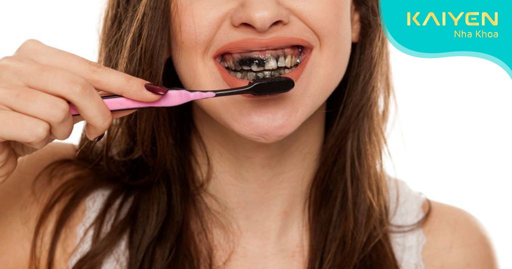Không thực hiện vệ sinh than hoạt tính kĩ càng dẫn đến mất men răng