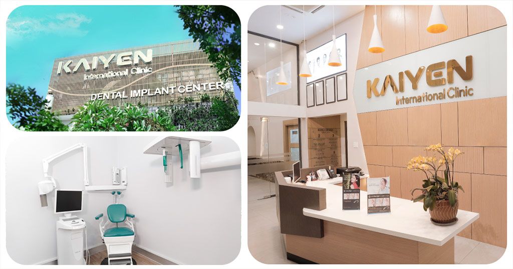 Nha khoa Quốc tế KAIYEN – Địa chỉ trồng răng Implant uy tín