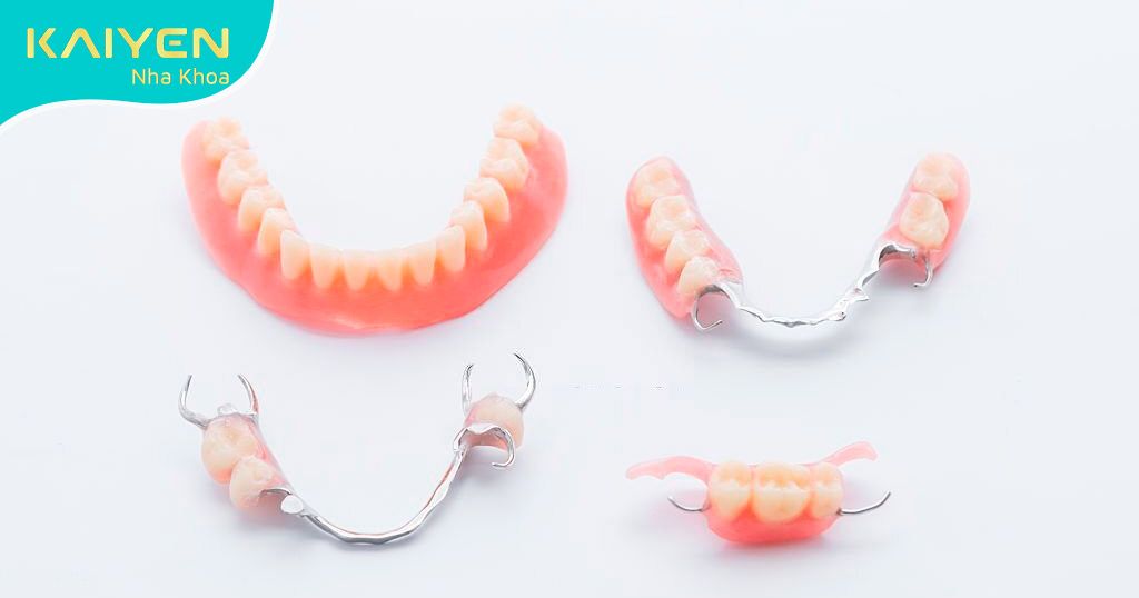 Hàm răng giả tháo lắp dễ bị lỏng lẻo khi sử dụng