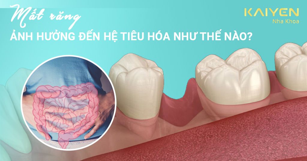 Mất răng ảnh hưởng đến hệ tiêu hoá như thế nào?