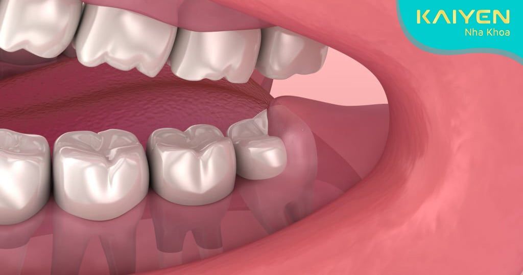 Răng hàm có vai trò trong hoạt động ăn nhai
