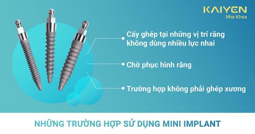 những trường hợp sử dụng mini implant