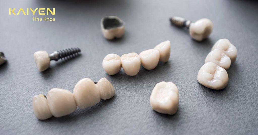 Vật liệu làm răng sứ phải có nguồn gốc rõ ràng