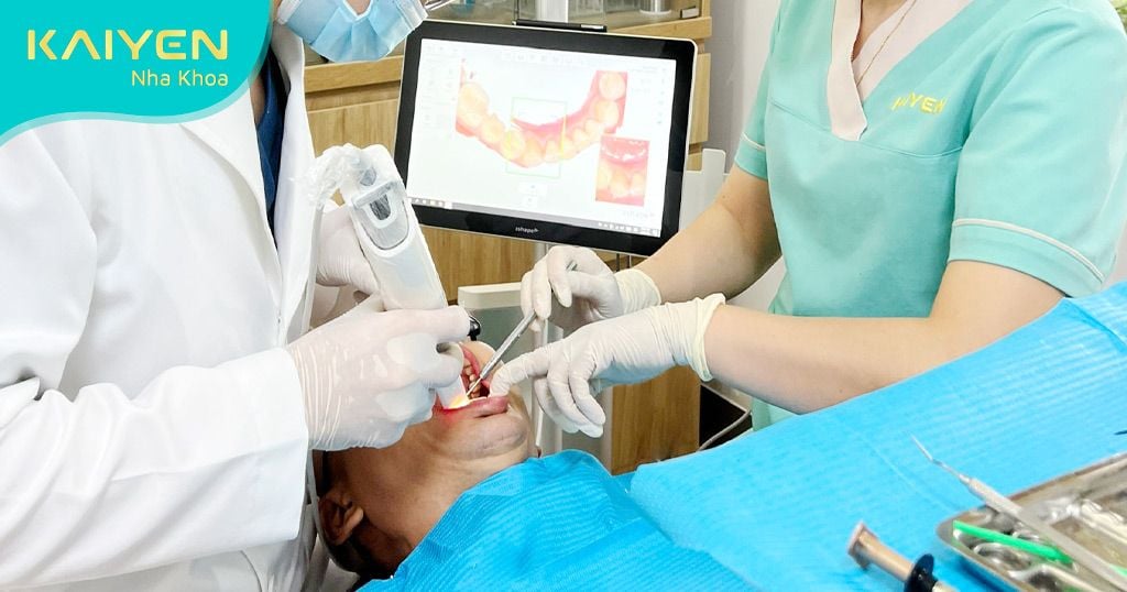 Nhổ răng khôn tại Nha khoa KAIYEN an toàn, không đau
