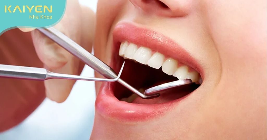 Tiền mê trong nhổ răng giúp bệnh nhân có tâm lý thoải mái