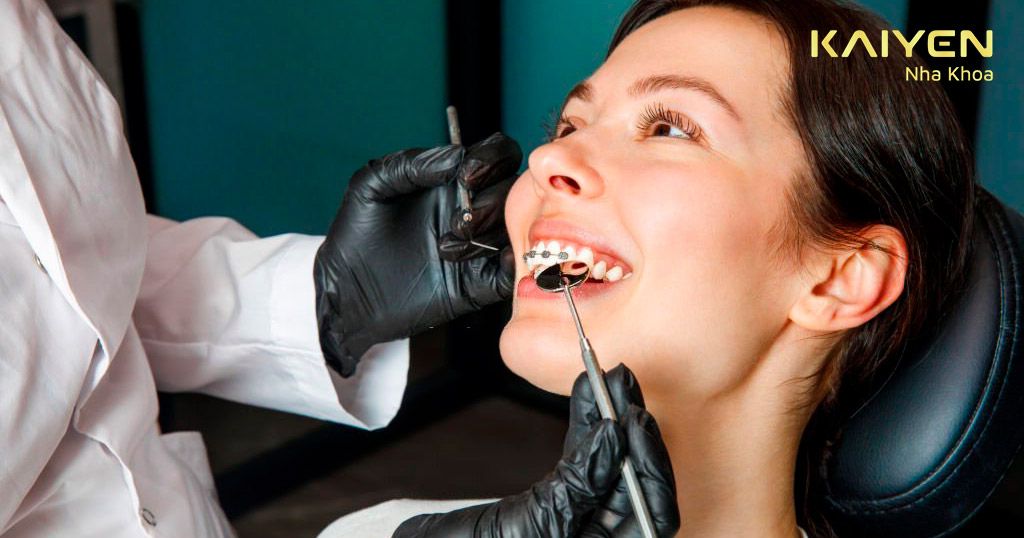 Răng có yếu đi sau niềng không phụ thuộc vào tay nghề bác sĩ