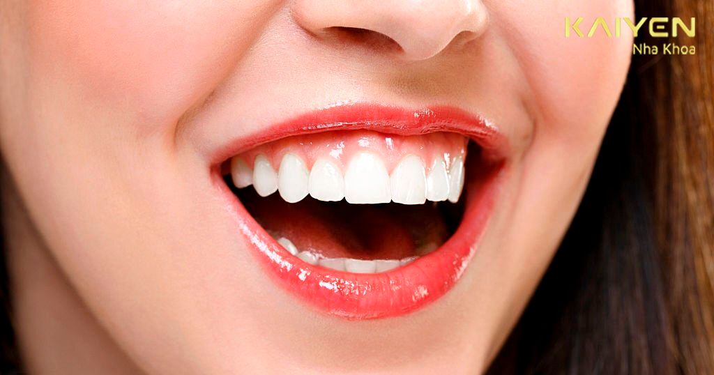 Răng hô móm gây mất thẩm mỹ răng miệng