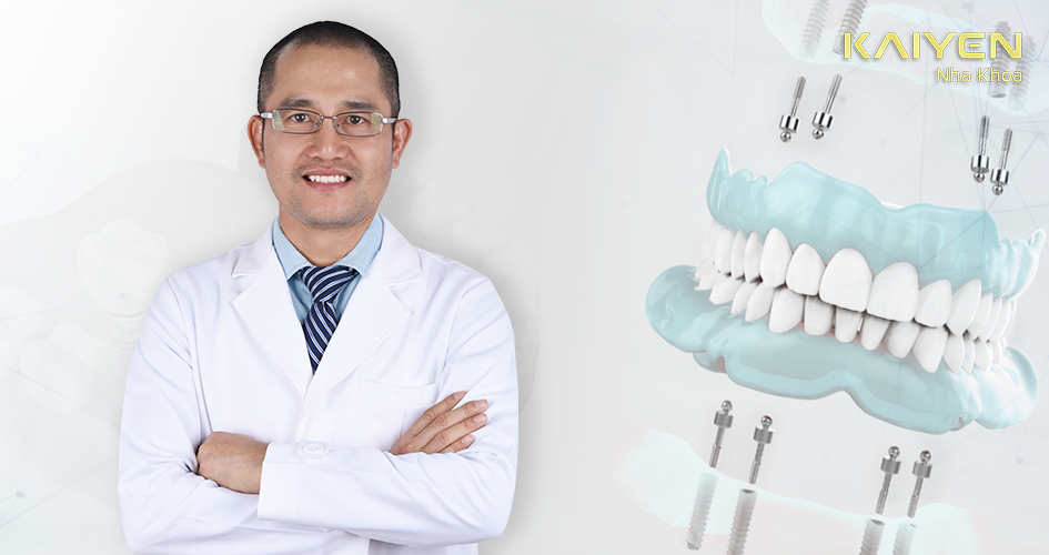 Bác sĩ tiên phong implant