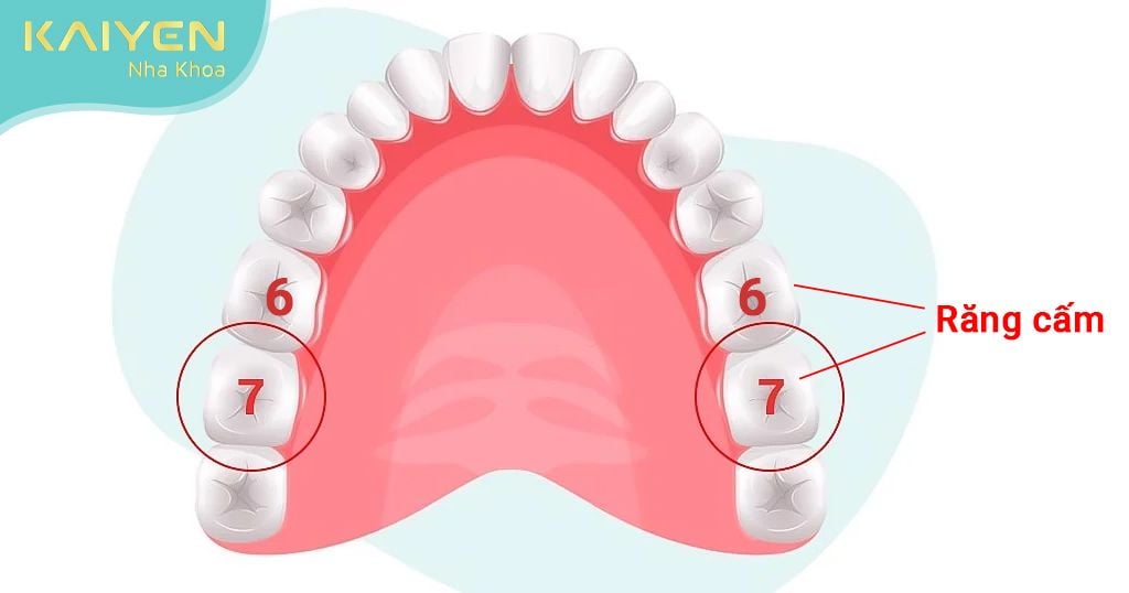 Răng cấm là răng hàm số 6, số 7