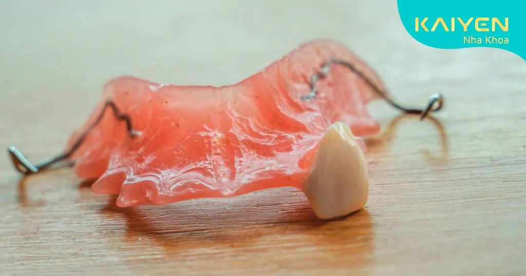 Răng giả tháo lắp 1 cái trên khung nhựa dẻo