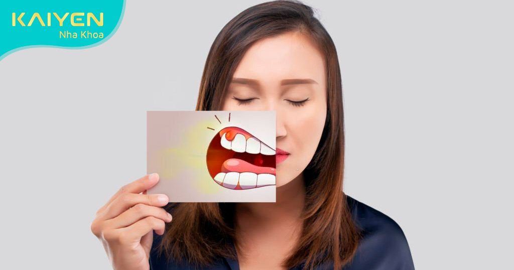 Quá trình niềng răng bị ảnh hưởng xấu khi bệnh lý răng miệng chưa được trị khỏi