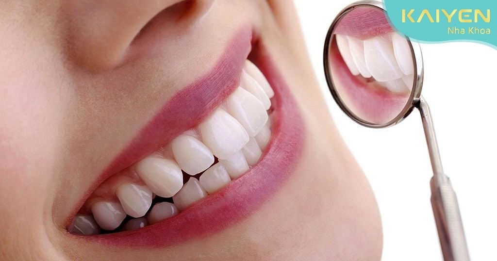 Răng sứ thẩm mĩ mang đến nụ cười đẹp cùng chức năng ăn nhai tốt hơn