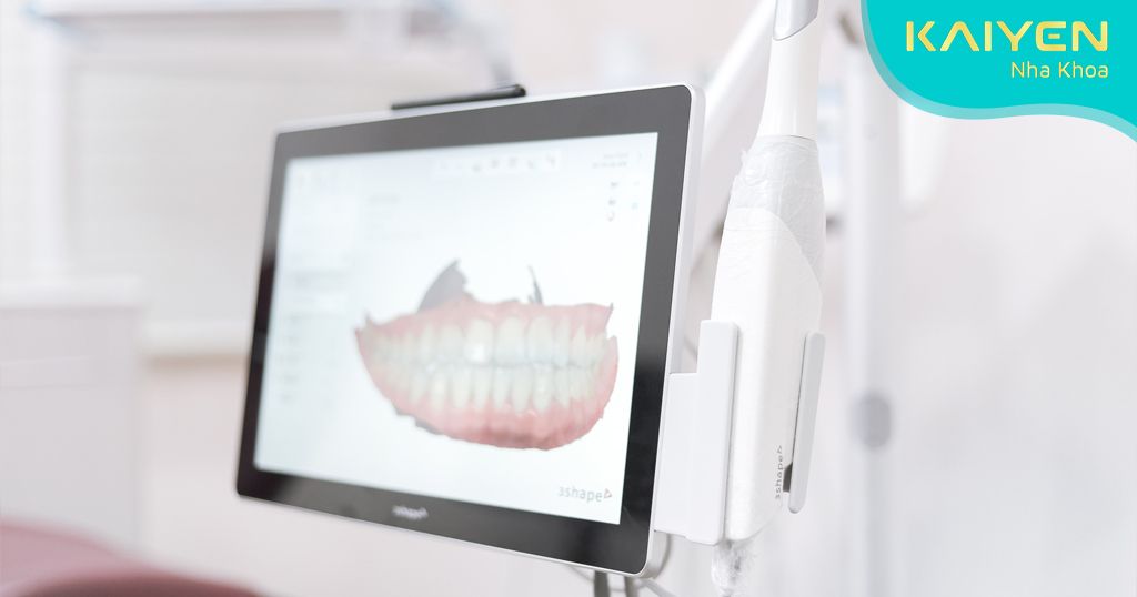 Cơ sở nha khoa uy tín với máy móc hiện đại giúp đảm bảo chất lượng răng sứ