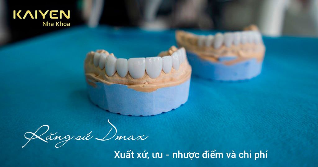 Răng sứ Dmax (Đức)