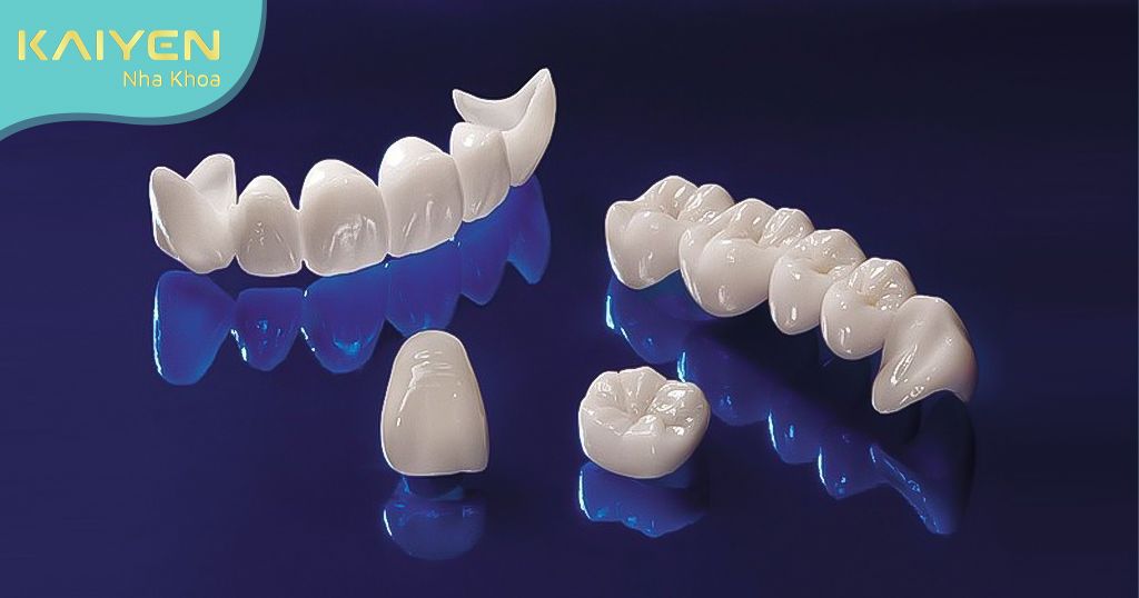 Chi phí bọc răng sứ Nano 5S sẽ cao hơn các phương pháp bọc răng sứ cũ