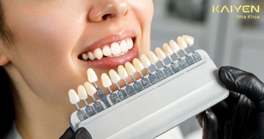 Lựa chọn nha khoa uy tín làm răng sứ an toàn