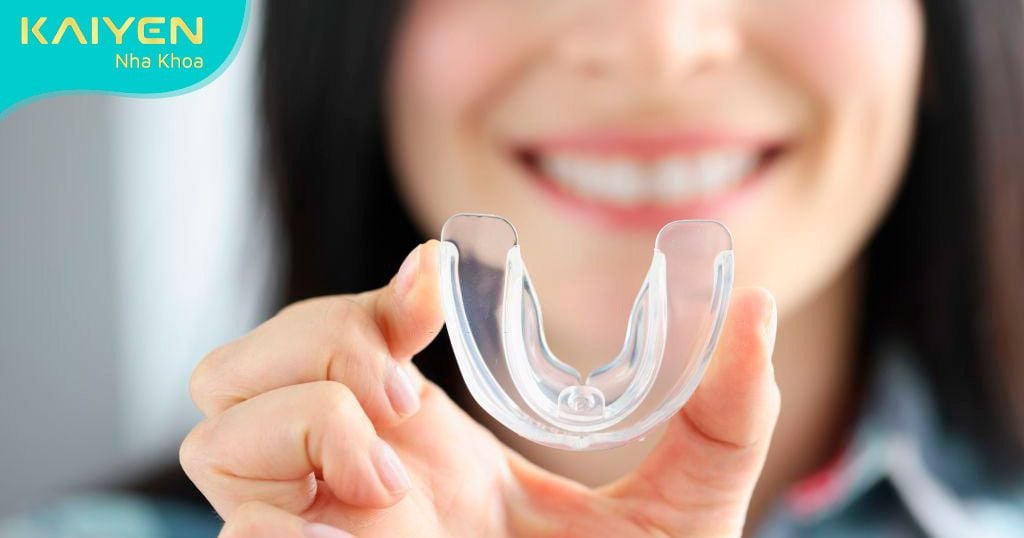 Dùng hàm bảo vệ để tránh nghiến răng gây ảnh hưởng đến răng sứ