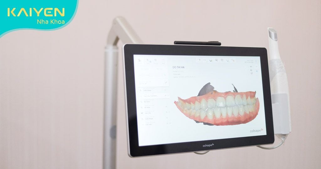 Ứng dụng công nghệ hiện đại trong làm răng sứ