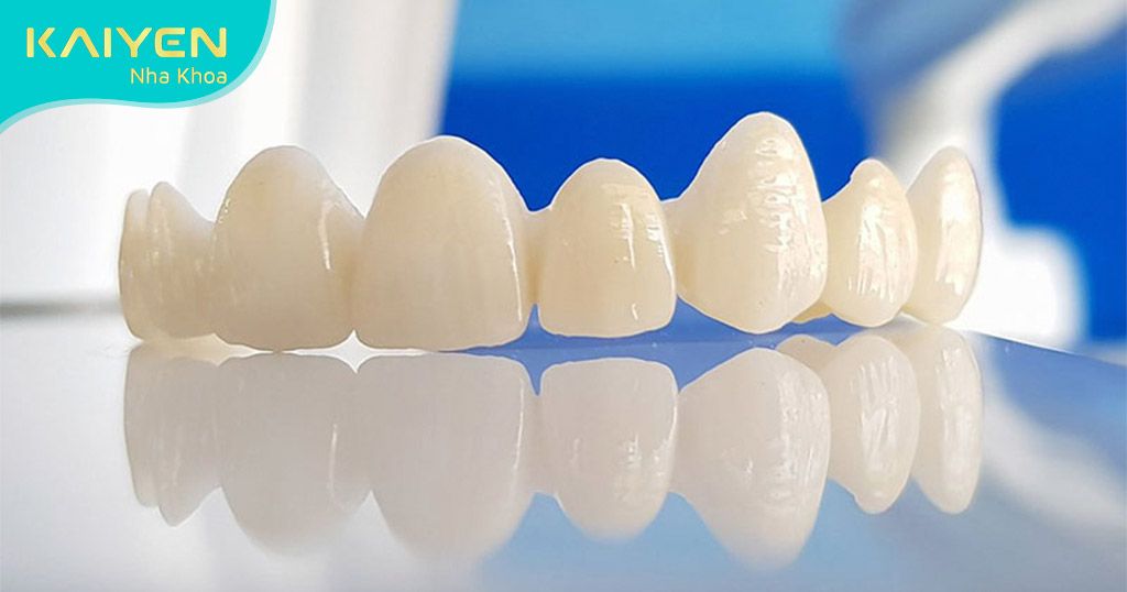 Răng sứ giống răng thật có tính thẩm mỹ cao