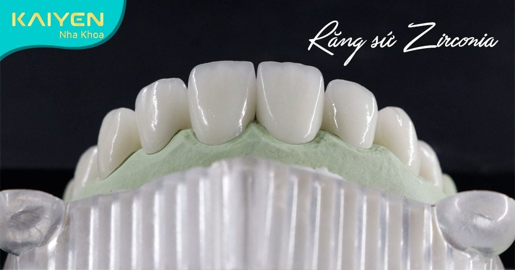 Răng sứ Zirconia không gây đen viền nướu