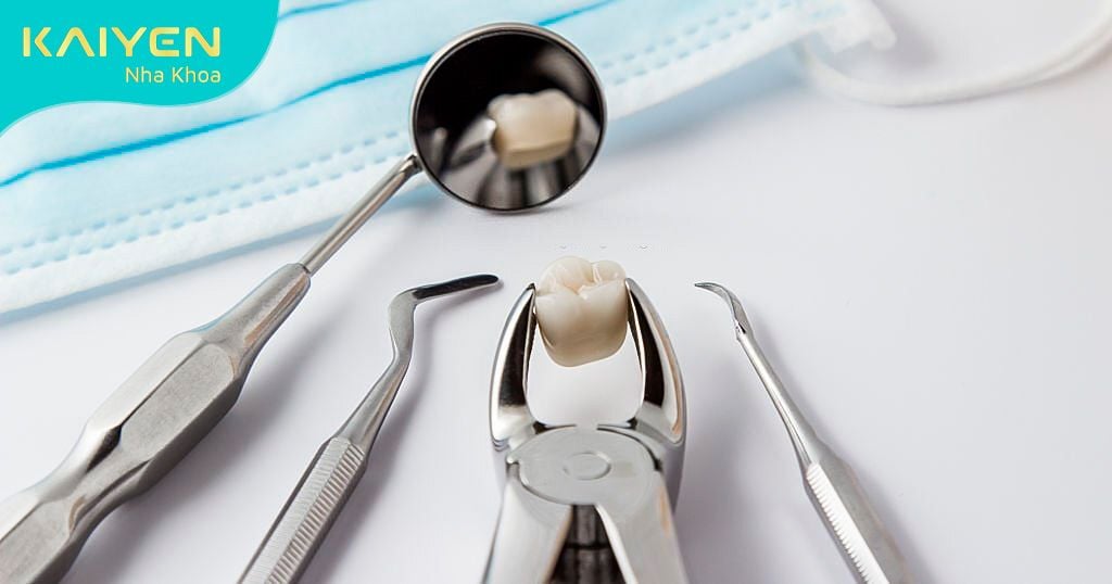 Nhổ bỏ răng khôn điều trị dứt điểm cơn đau