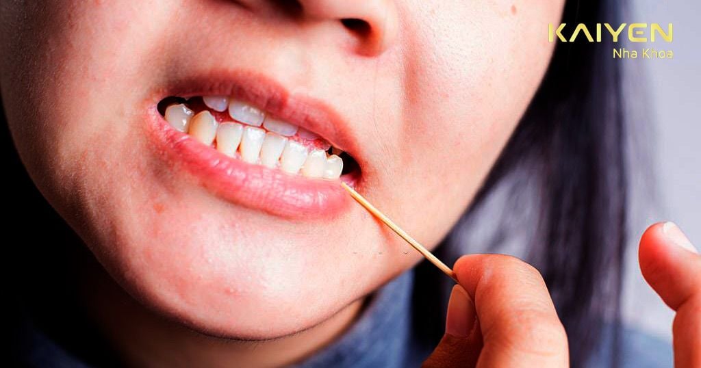 Loại bỏ thói quen dùng tăm xỉa răng