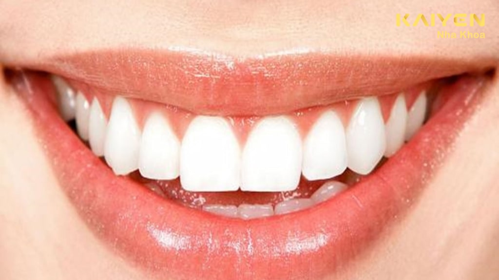 tái tạo tính thẩm mỹ cho răng