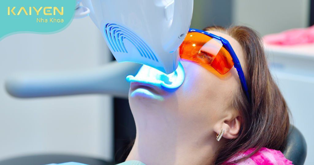 Công nghệ tẩy trắng răng Laser Whitening