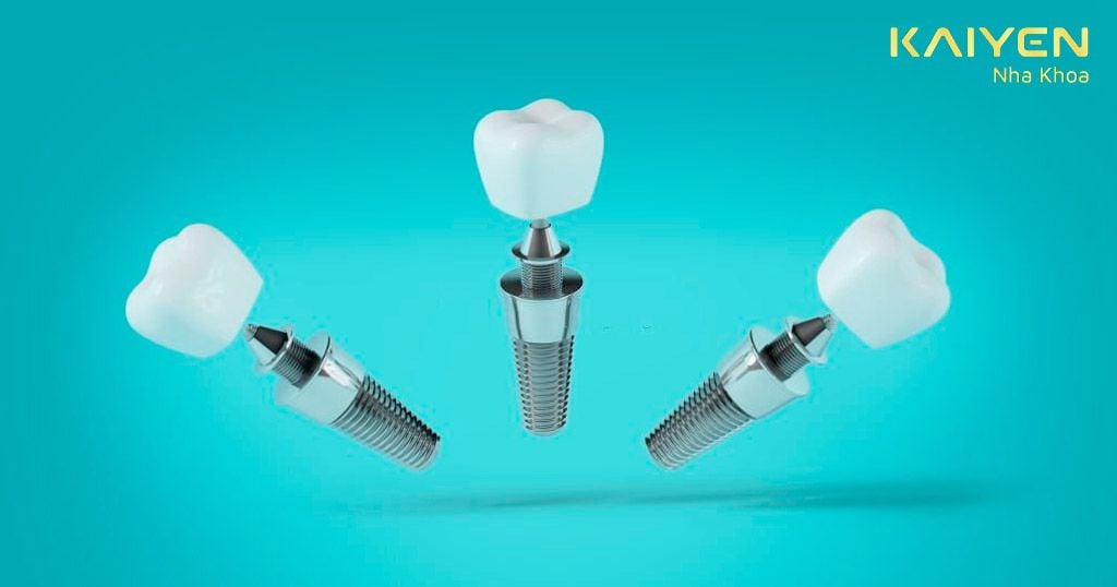 Lựa chọn các loại trụ Implant chính hãng, chất lượng cao
