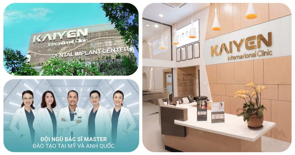 Nha khoa KAIYEN – Địa chỉ uy tín khắc phục mọi vấn đề răng miệng
