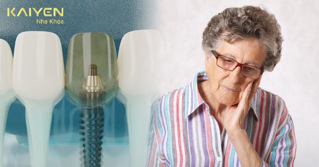 Trồng răng Implant cho người già có được không? Chi phí răng giả bao nhiêu?
