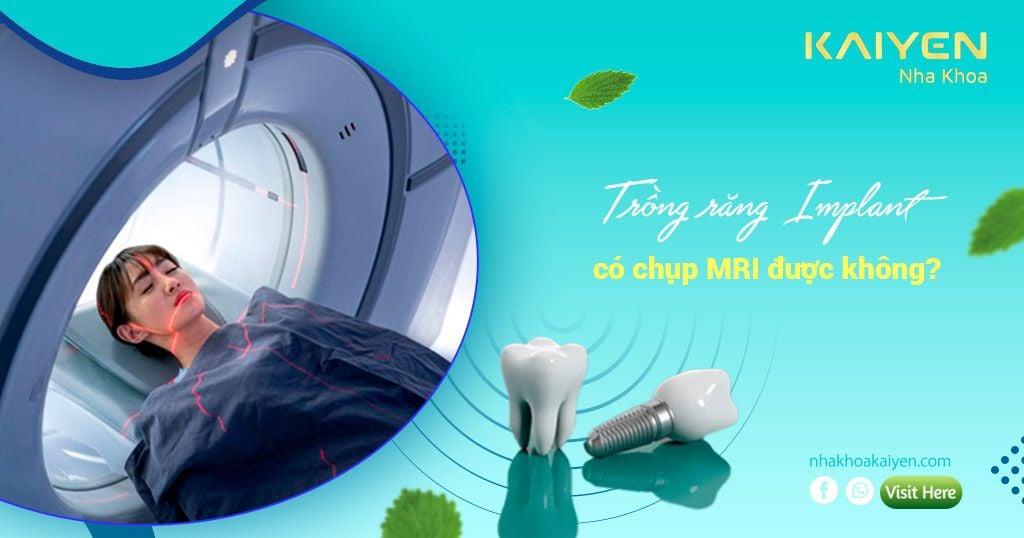 Các Lưu Ý Khi Chụp MRI Đối Với Người Trồng Răng Implant