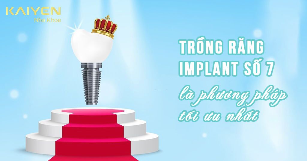 Trồng răng số 7 bằng Implant là phương pháp tối ưu nhất