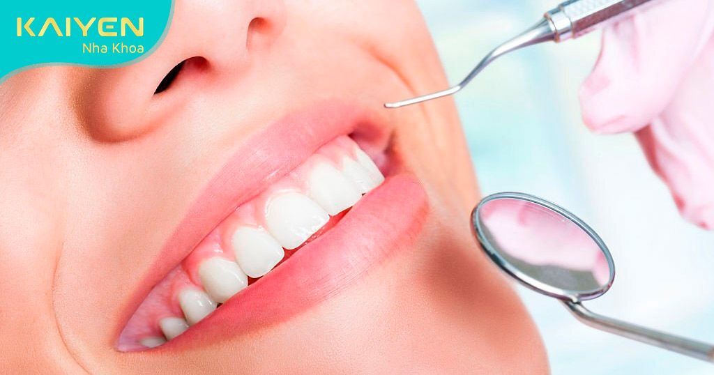 Chăm sóc răng Implant đúng cách duy trì tuổi thọ lâu dài