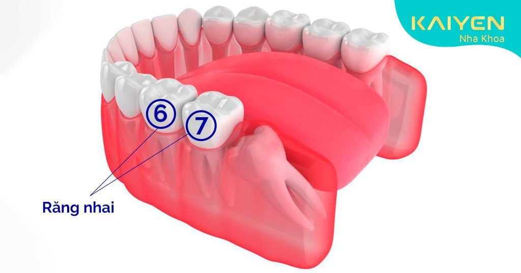 Răng hàm số 6 và số 7 là những răng đảm nhiệm chức năng ăn nhai