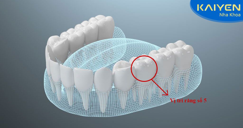 Tính từ răng cửa vào thì răng số 5 nằm ở vị trí thứ 5