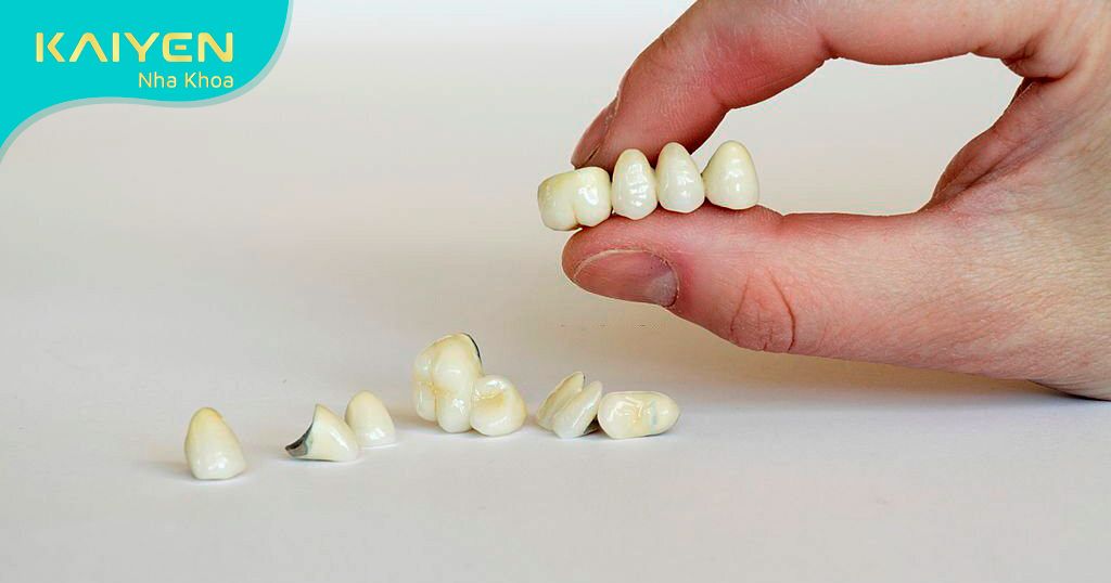 Răng sứ Titan được cấu tạo từ kim loại và lớp sứ bên ngoài giúp chịu lực rất tốt
