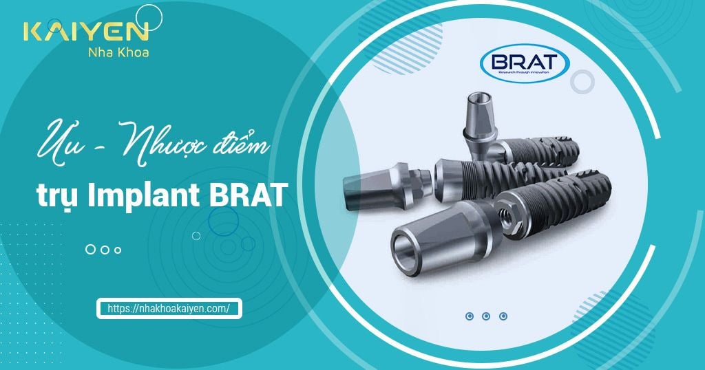 Review ưu nhược điểm của trụ Implant Brat