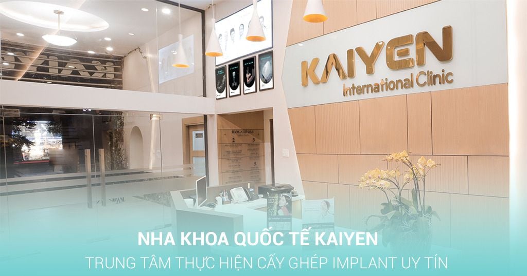 Nha khoa Quốc tế KAIYEN – Trung tâm thực hiện cấy ghép Implant uy tín