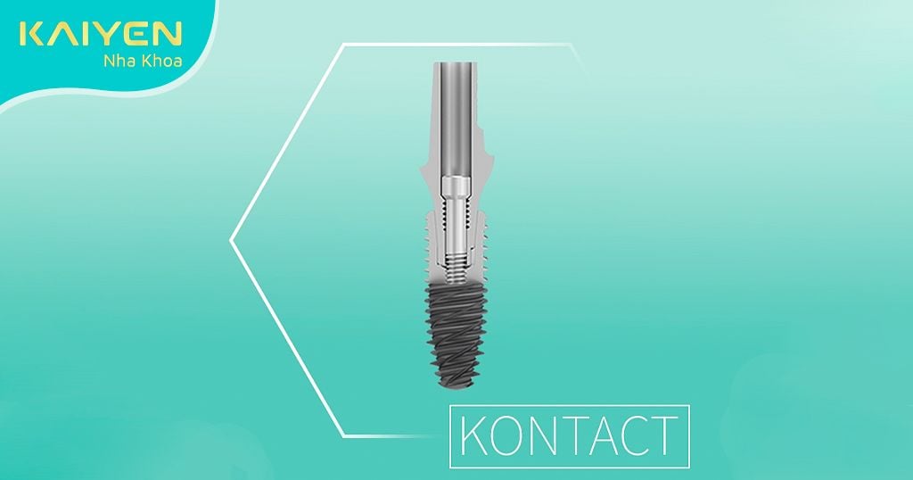 Chi phí cấy ghép Implant Kontact Pháp phụ thuộc vào nhiều yếu tố