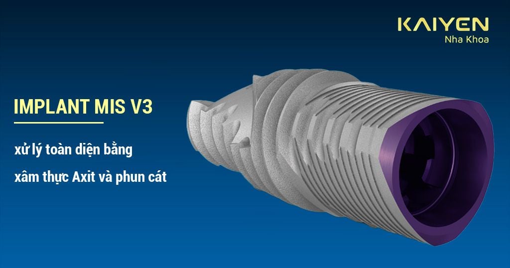 Implant MIS V3 được chế tác từ 99.8 – 100% vật liệu Titanium Oxit