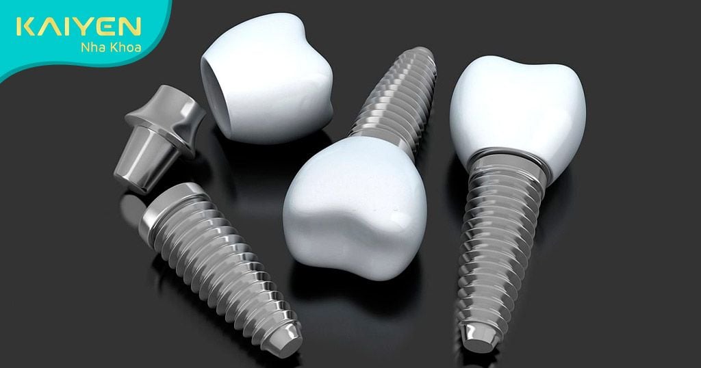 Trụ Titanium có trọng lượng rất nhẹ