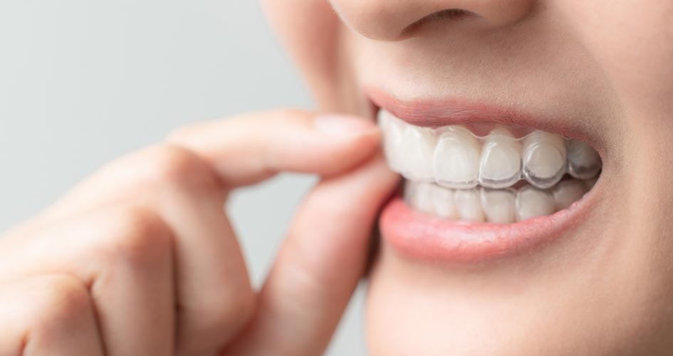 Khớp cắn ngược (răng móm) gây mất thẩm mỹ và ảnh hưởng chức năng ăn nhai
