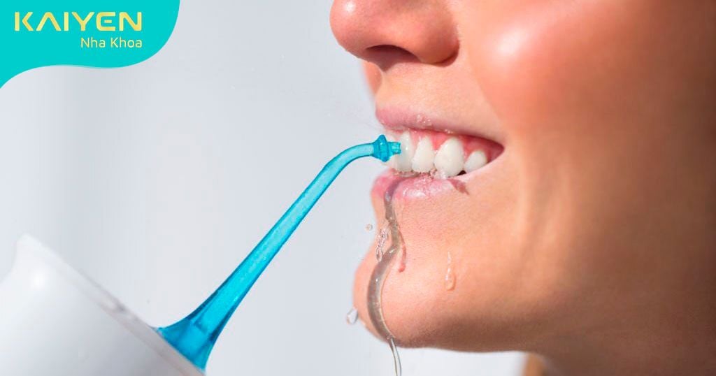 Dùng tăm nước để vệ sinh răng miệng sau khi trồng răng Implant