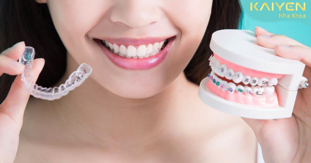 Đảm bảo thực hiện quy trình niềng răng tiêu chuẩn sẽ mang lại hiệu quả tốt hơn