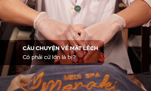 Câu chuyện về mặt lệch: Có phải cứ lớn là bị?