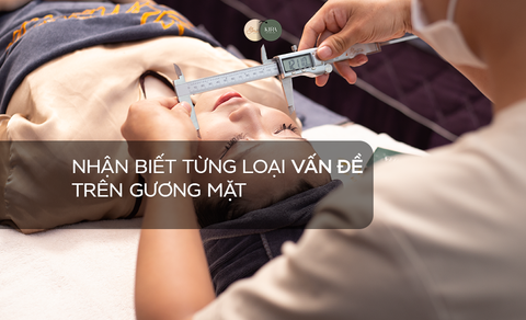 Nhận Biết Từng Loại Vấn Đề Trên Gương Mặt