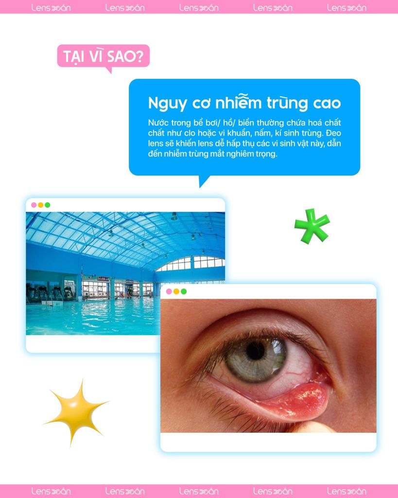 Cảnh báo không nên đeo lens đi bơi vì lý do an toàn cho mắt