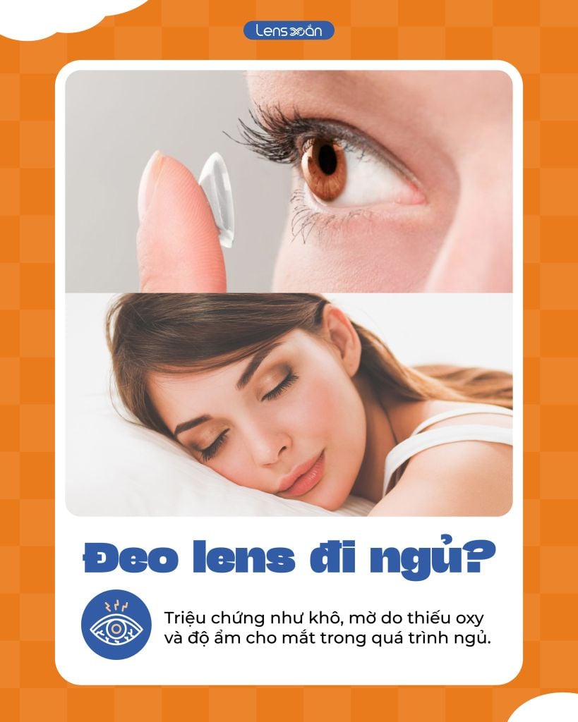 Lỡ ngủ quên khi đeo lens: Những điều bạn cần làm ngay